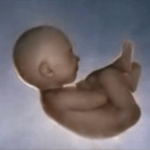 2009-11-10-skinjobs